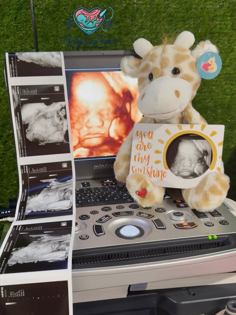 Baby ultrasound imaging