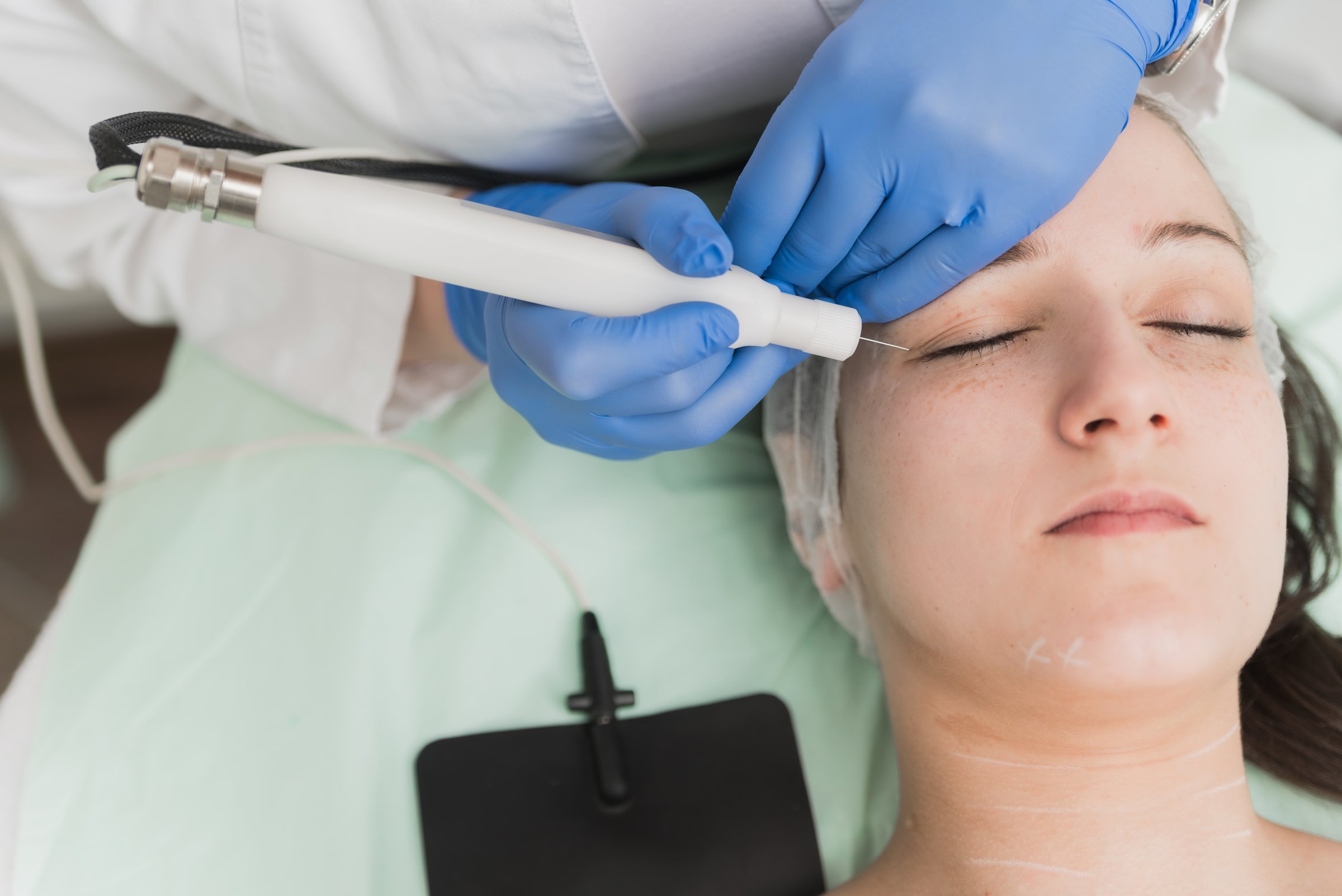 Closeup photo of female patient having cosmetical treatment for firming eyelids