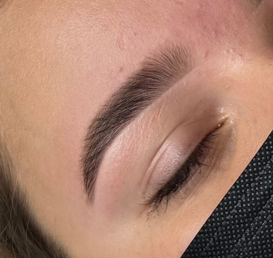 Bonnie Aesthetics client transformation