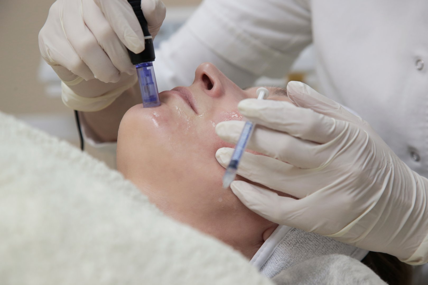 Mesotherapy. Woman having dermapen facial treatment. Micro needle cosmetic treatment at dermatologist.