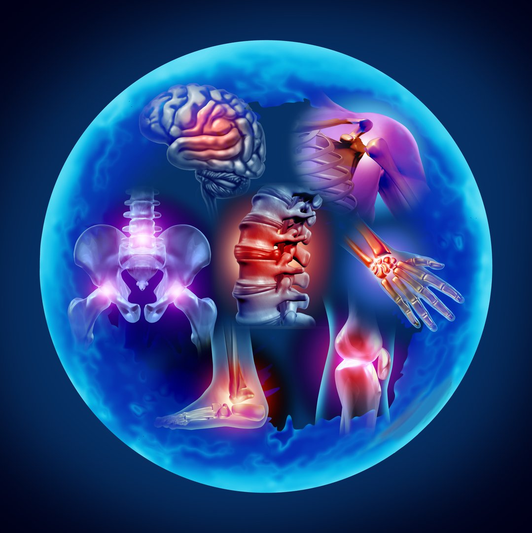 Nerve tingling and numbness illustration