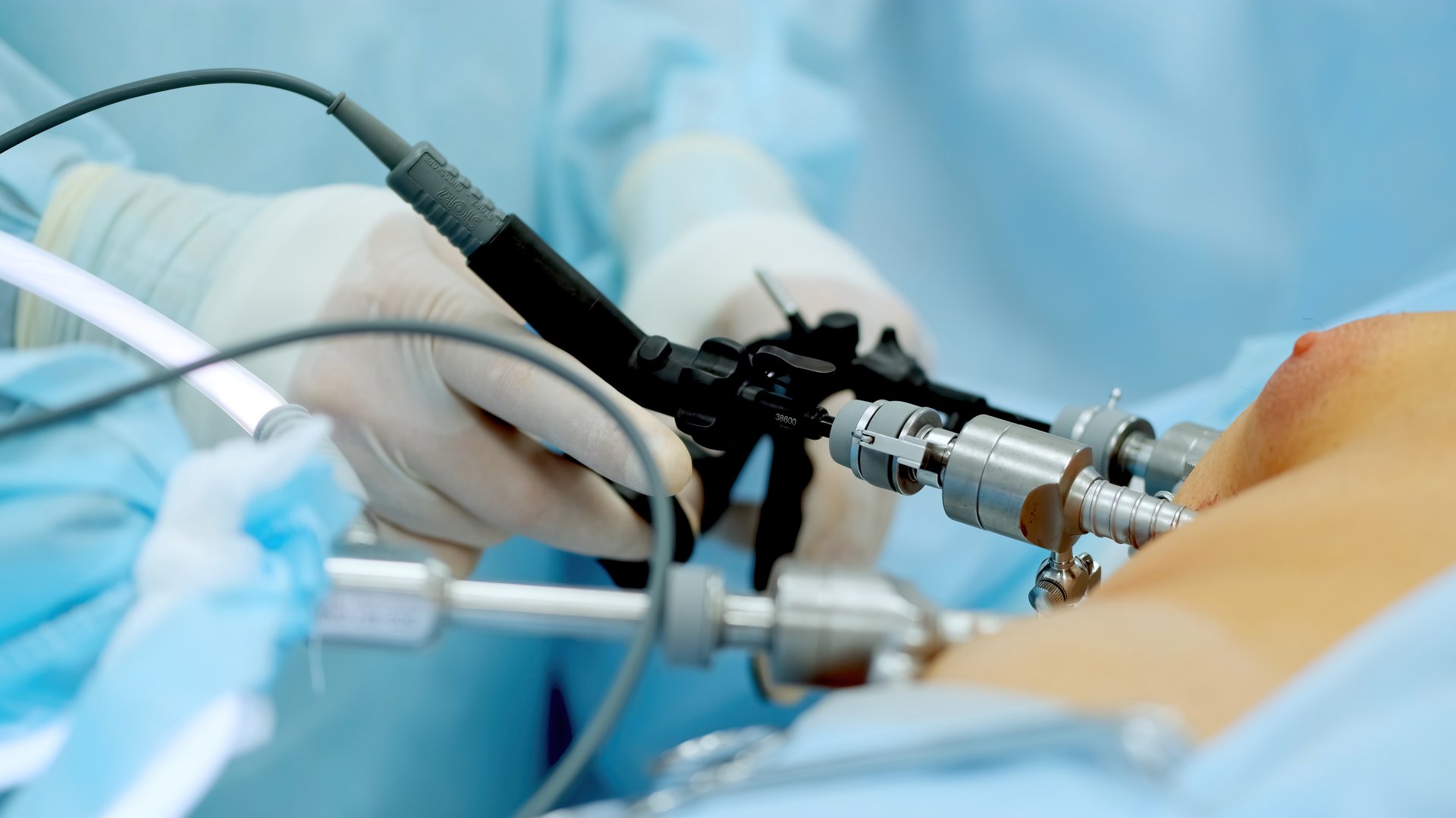 Hands of surgeons with the help of endoscopic equipment and instruments operate. performing laparoscopic surgery using endoscopic and laparoscopic instruments. laparoscopic instrument.