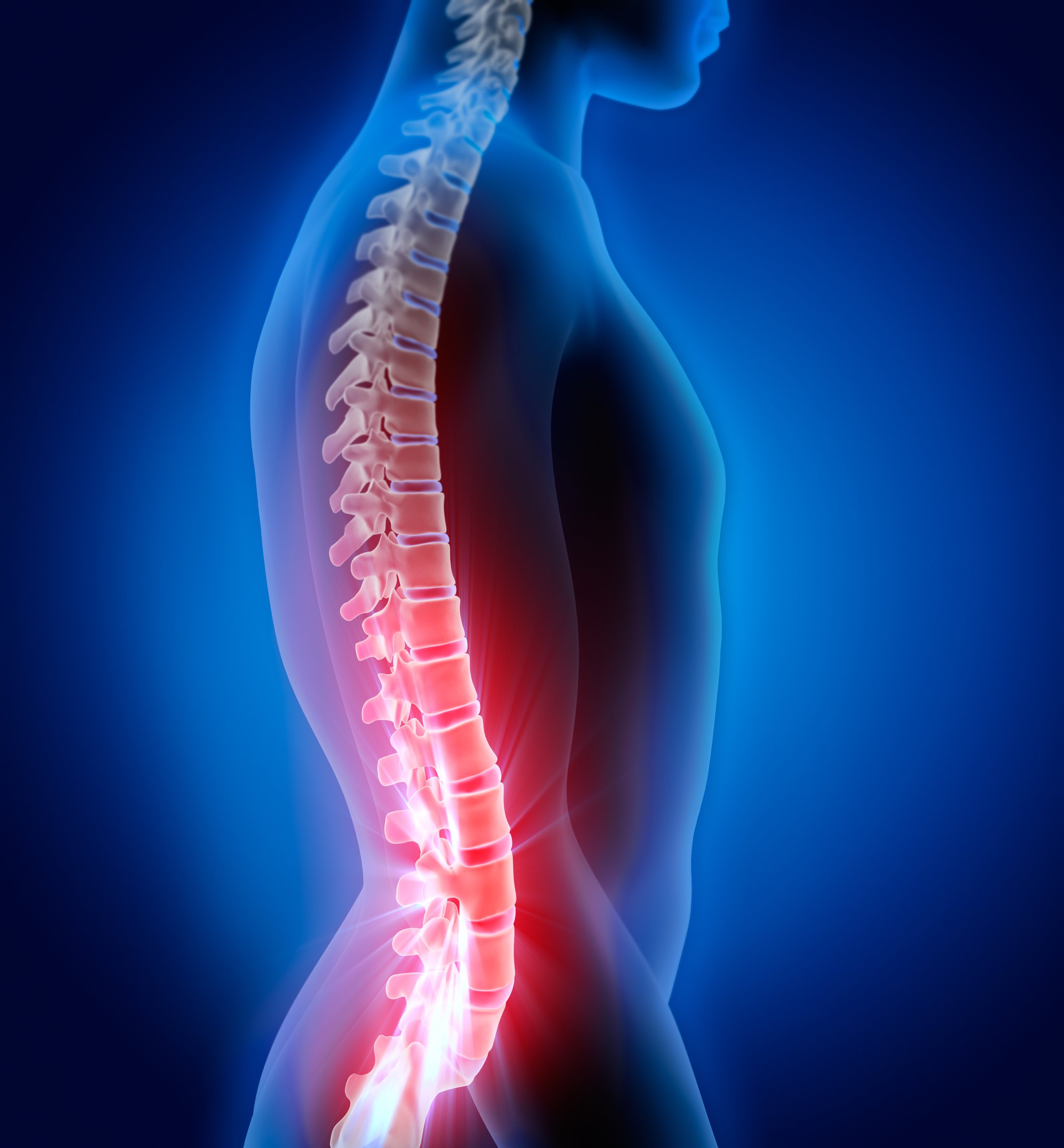 Spine with pain symptoms degenerative disc