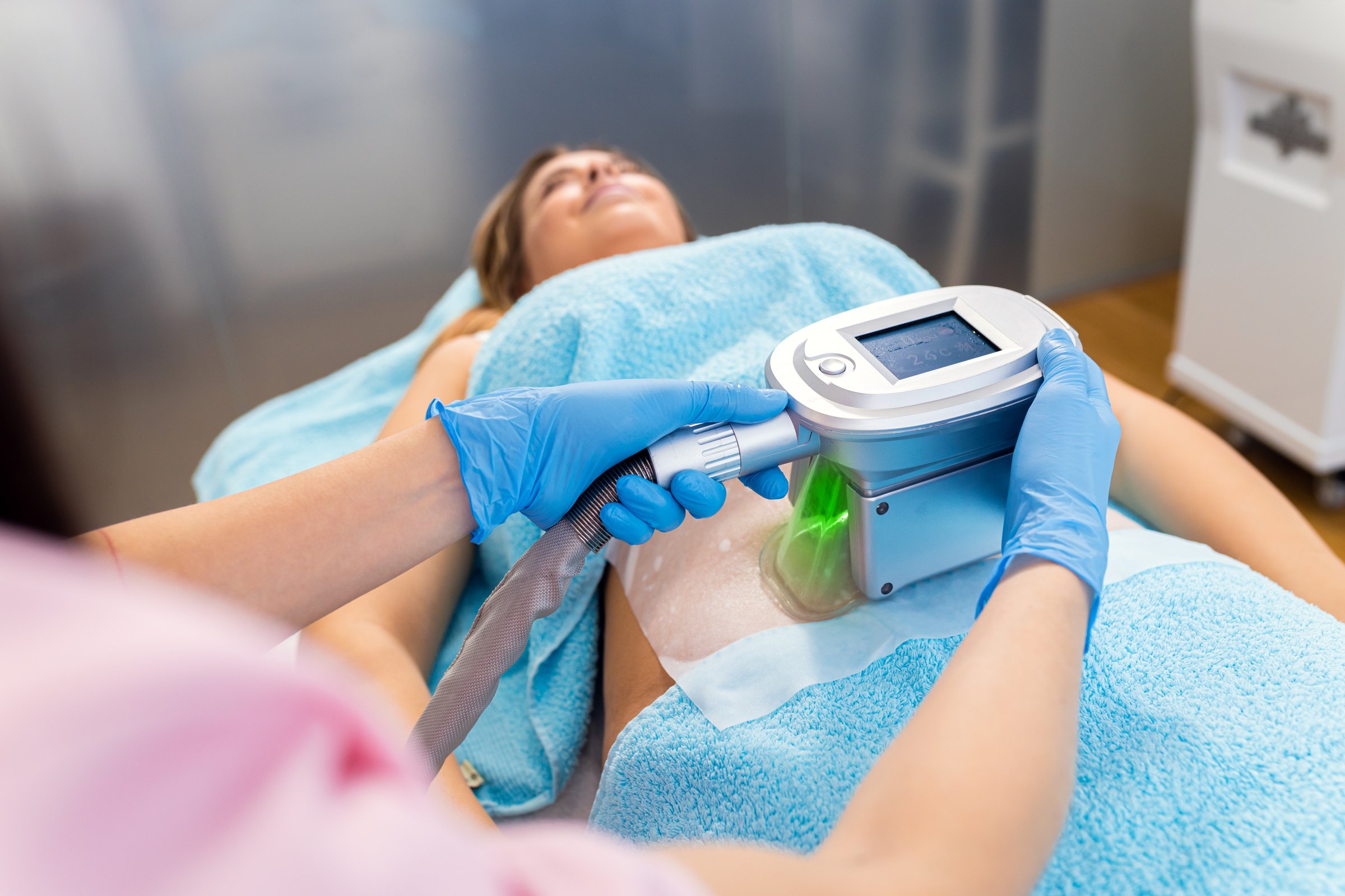 Cryolipolyse behandeling voor de onderbuik