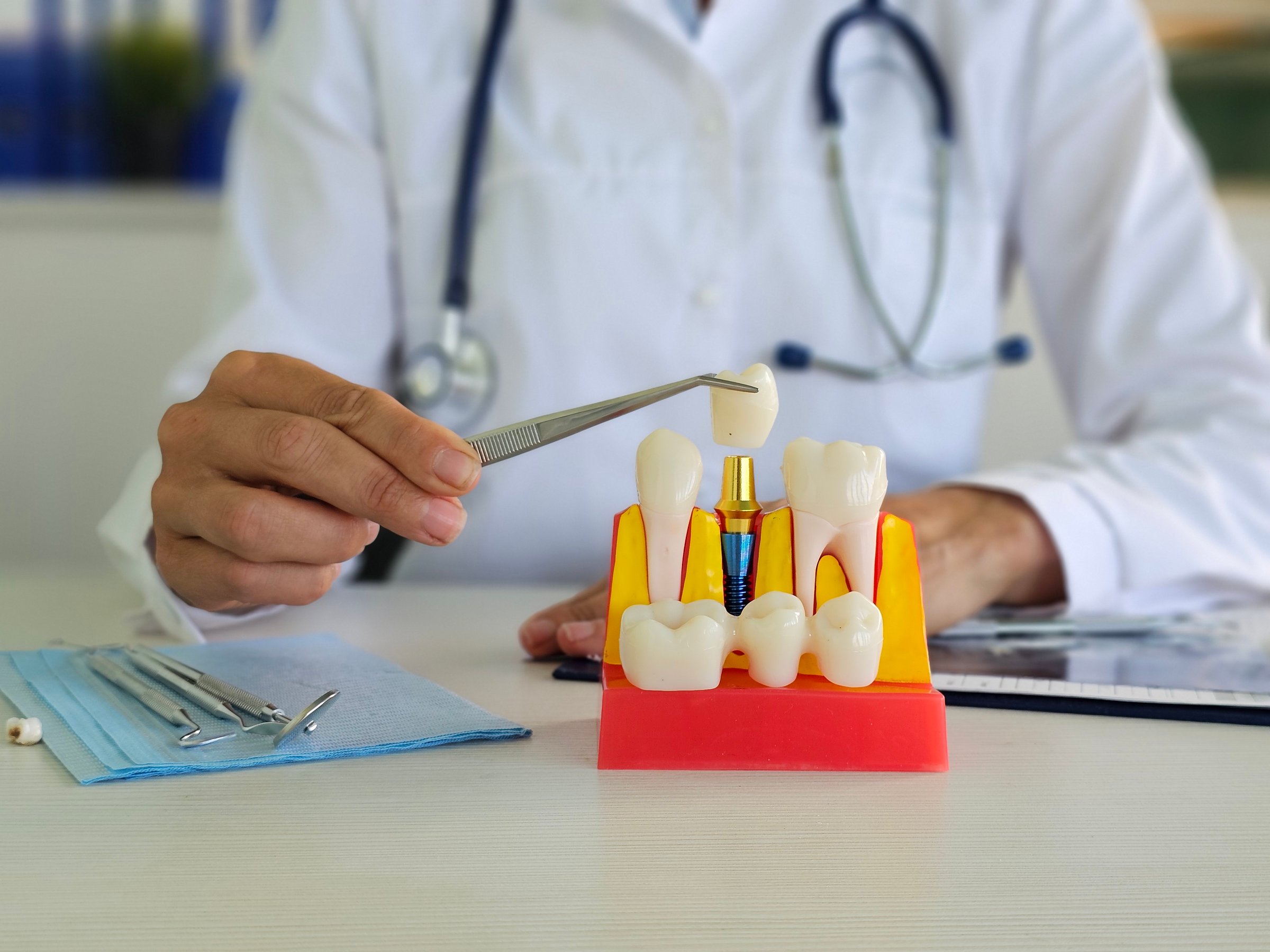 Dentist hand with model of human teeth, highlighting the dental implant crown, and advising on dental implant upkeep and oral hygiene