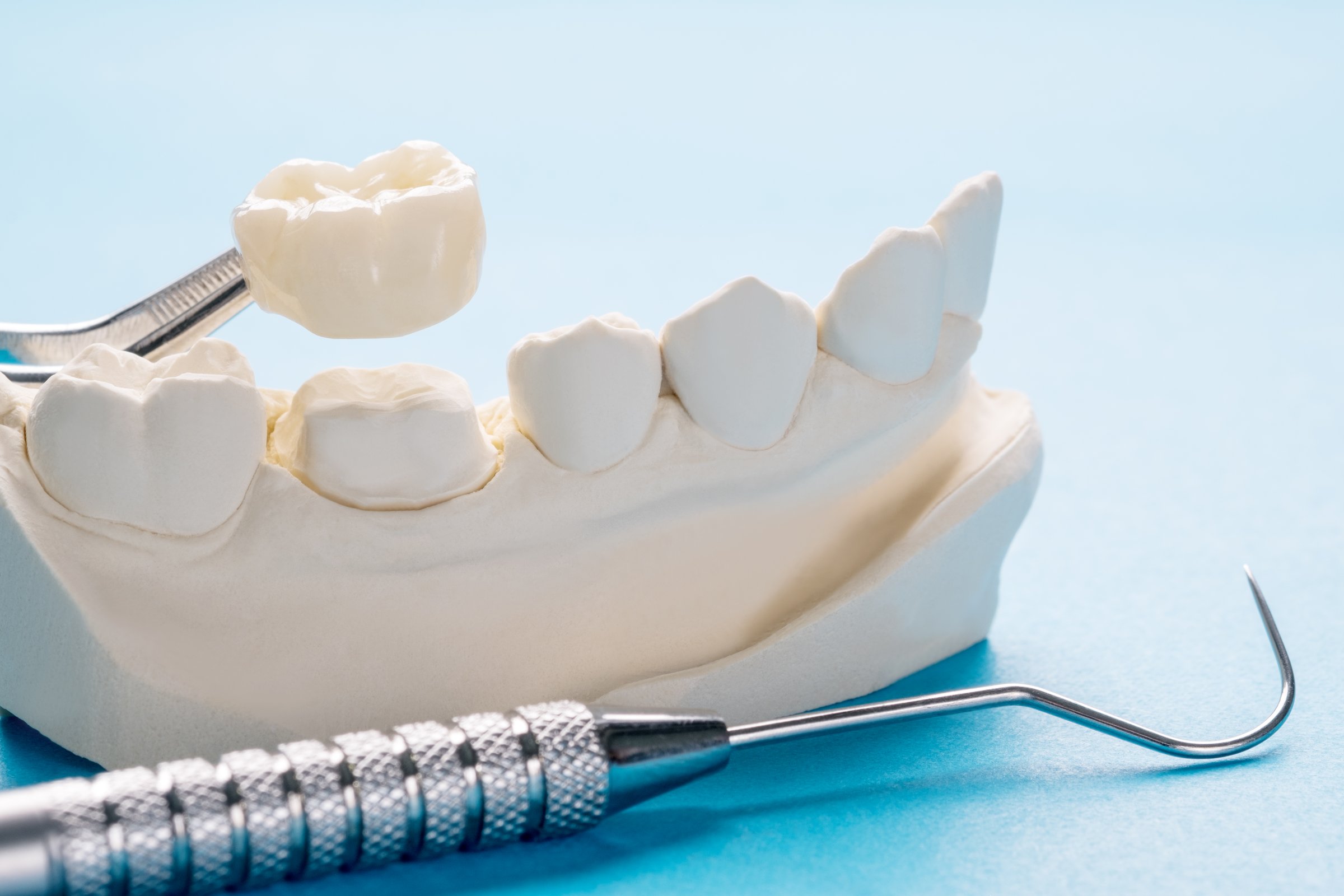 Closeup / Prosthodontics or Prosthetic / Single teeth crown and bridge equipment model express fix restoration.