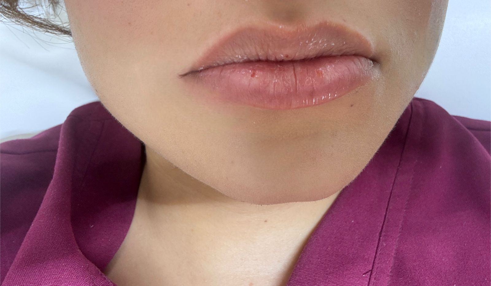 Resultado de micropigmentación de labios en Alyafi Morelia