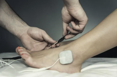 Electric Stimulation Therapy