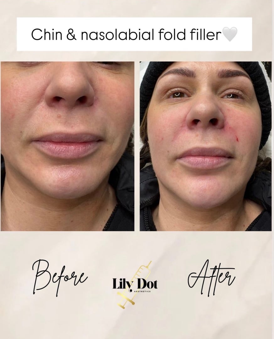 Stunning aesthetic enhancement