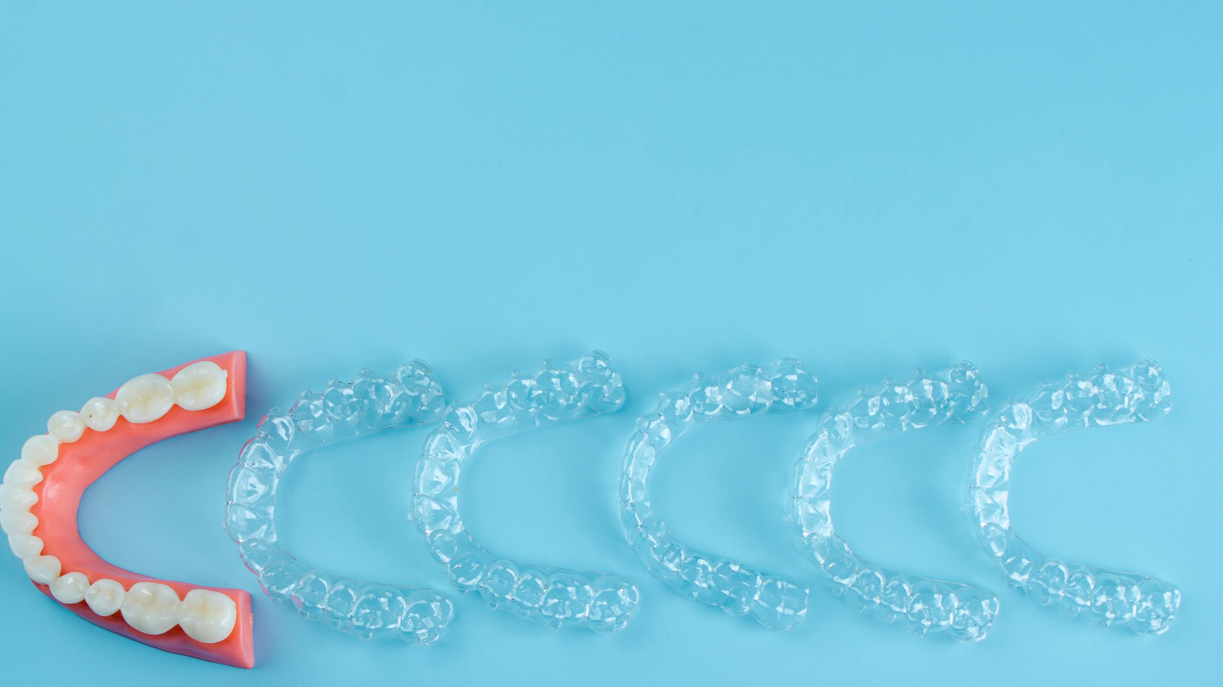 Invisalign treatment stages showing how long Invisalign takes for adult patients