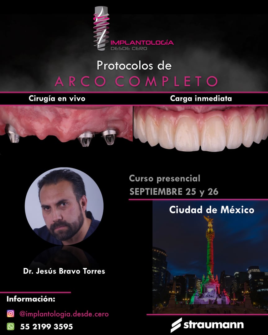 Promotional poster for a dental implant course in Mexico City on September 25-26, featuring Dr. Jesús Bravo Torres.