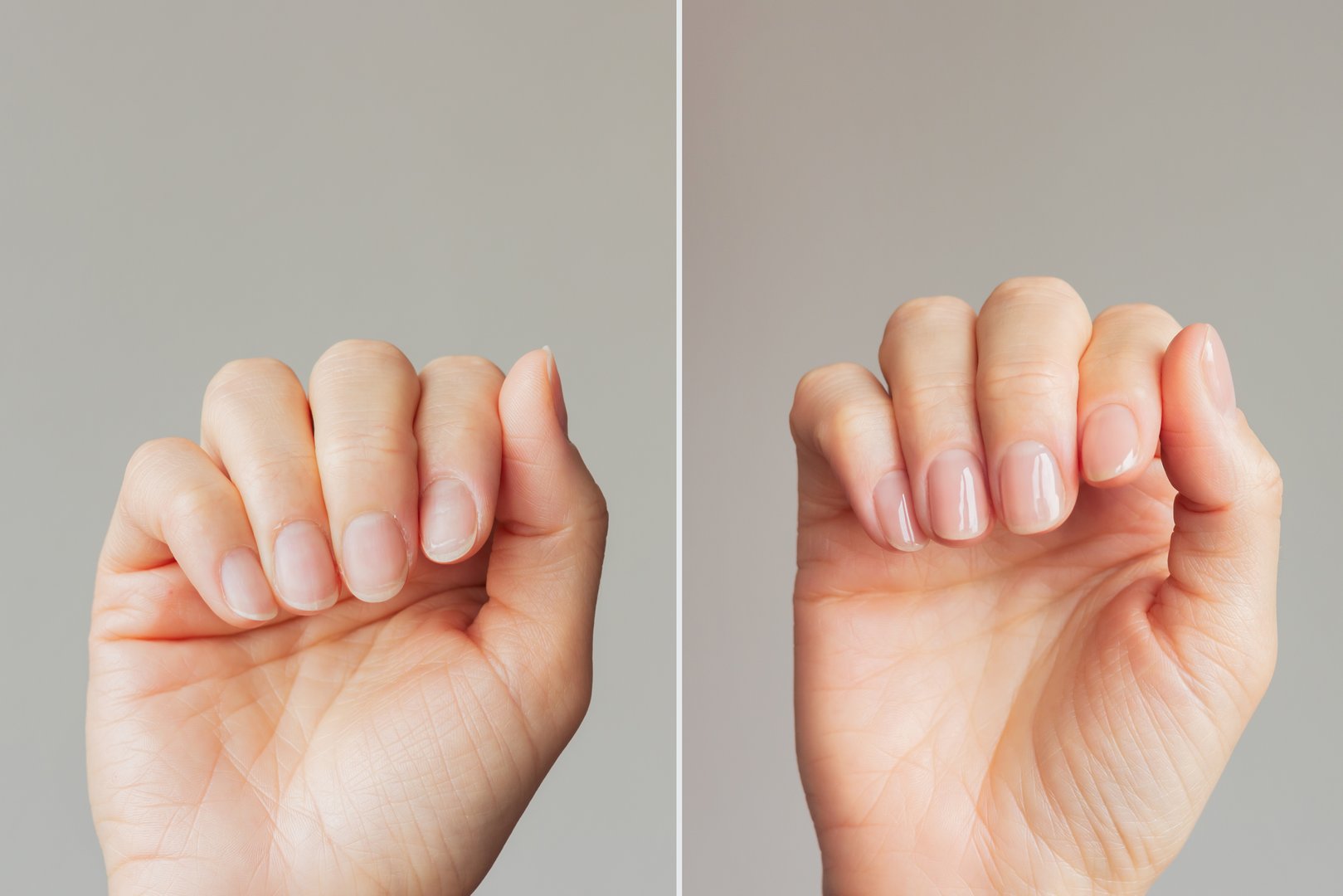 Close-up comparison before and after of a well-groomed female hands with a beautiful nude manicure on a gray background. Beauty and hand care