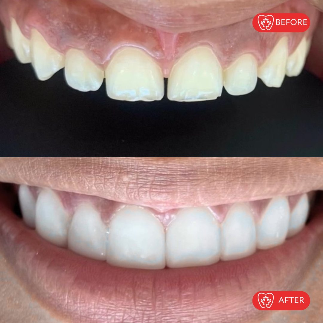 Después del tratamiento