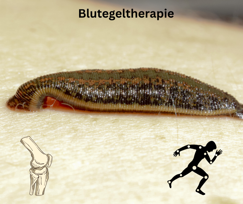 Blutegeltherapie Behandlung