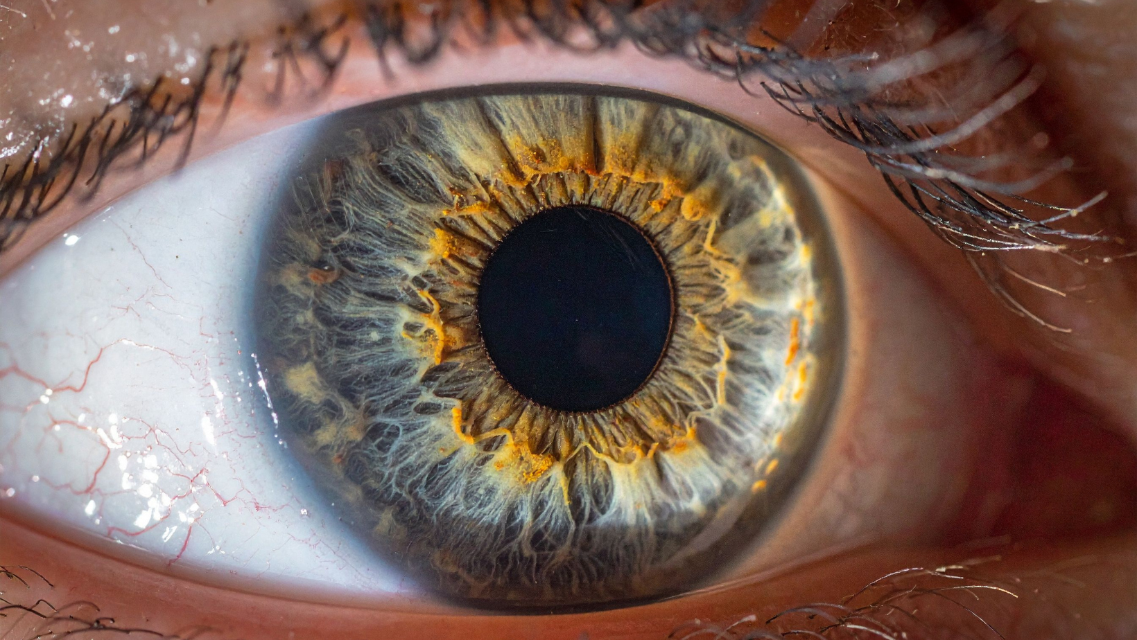 Rootonika iridology wellness