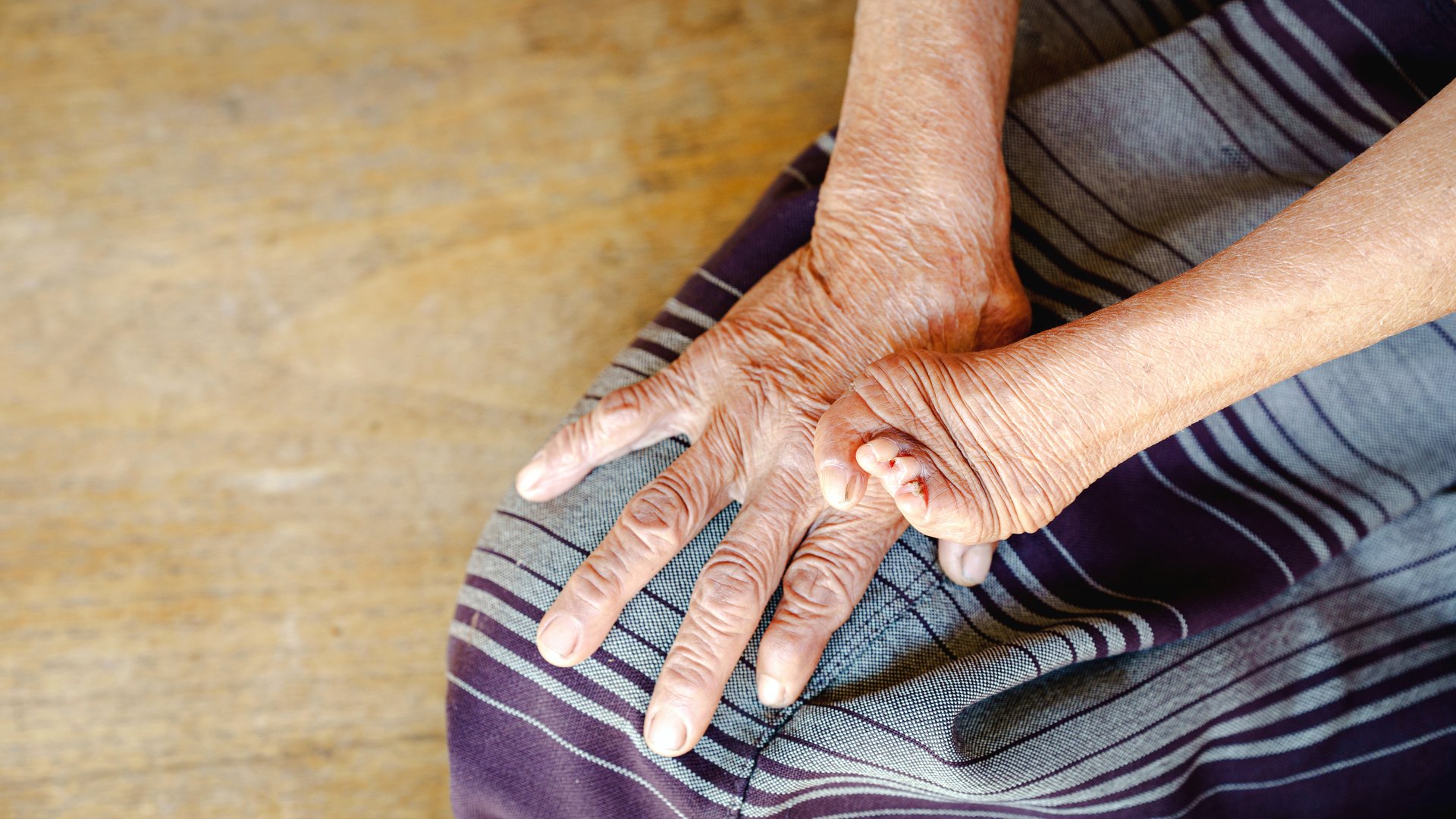 Emotional Portrait of an Elderly Woman with Amputated Hand Resting on Her Lap in Natural Light