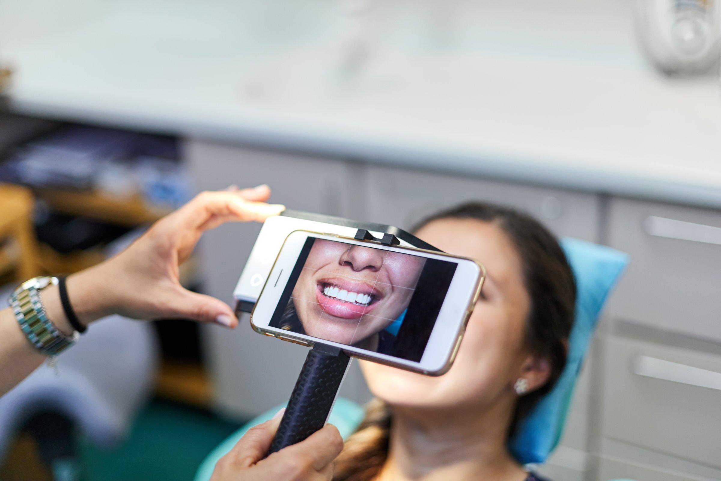 From above soft focus of crop dentist using smartphone on monopod to take photo of female patient smile for portfolio during appointment in office of dental clinic