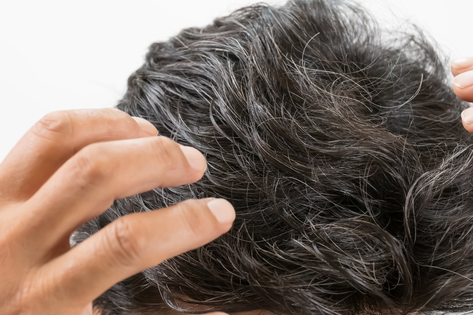 Density Levels for Hair Systems