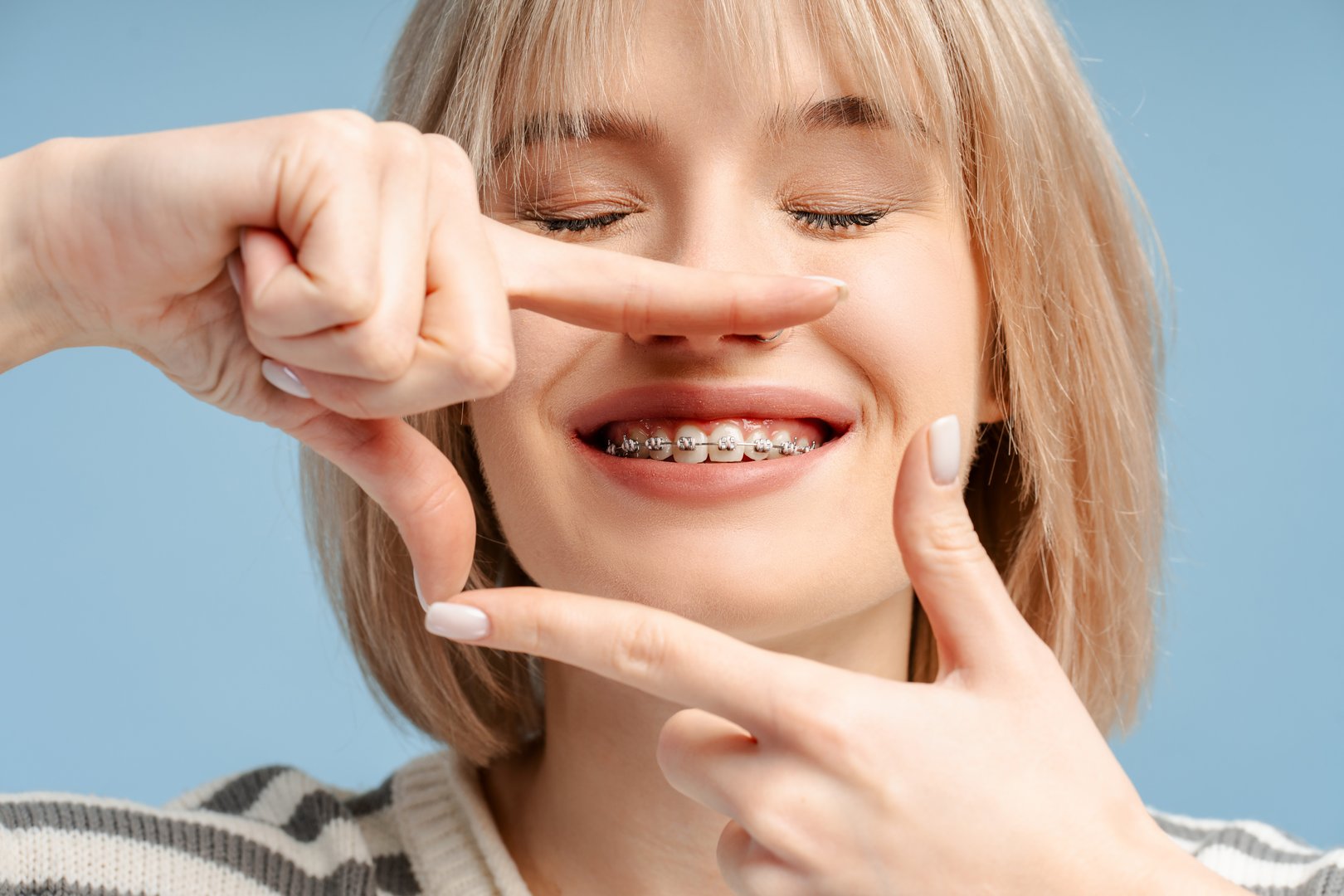 Young woman patient with braces smiling