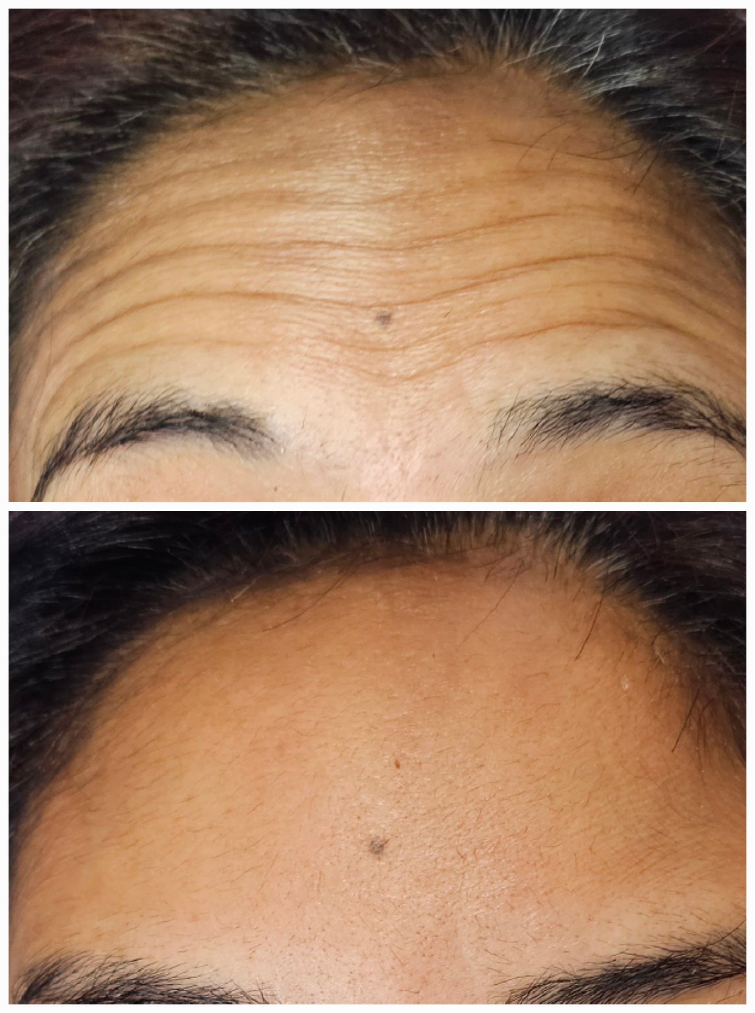 Resultado del tratamiento