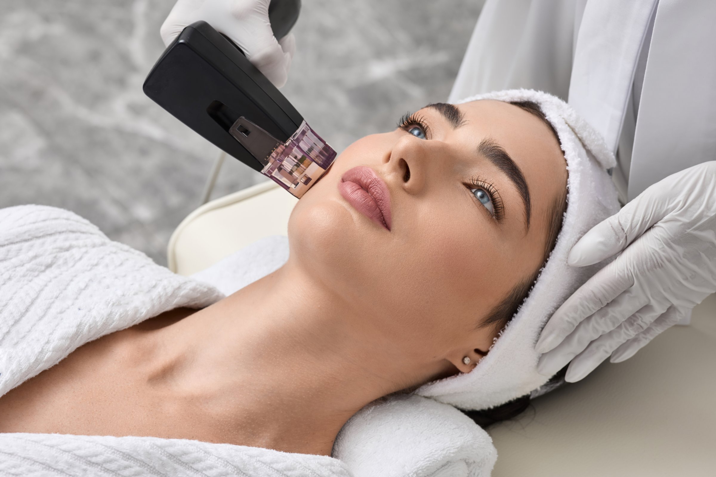 Brunette woman receiving radiofrequency lifting procedure for her face skin rejuvenation at aesthetic cosmetology clinic