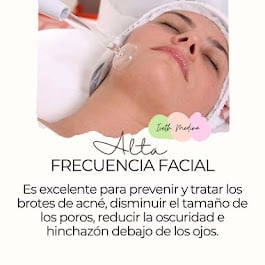 Tratamientos profesionales en IvethCare Cuernavaca