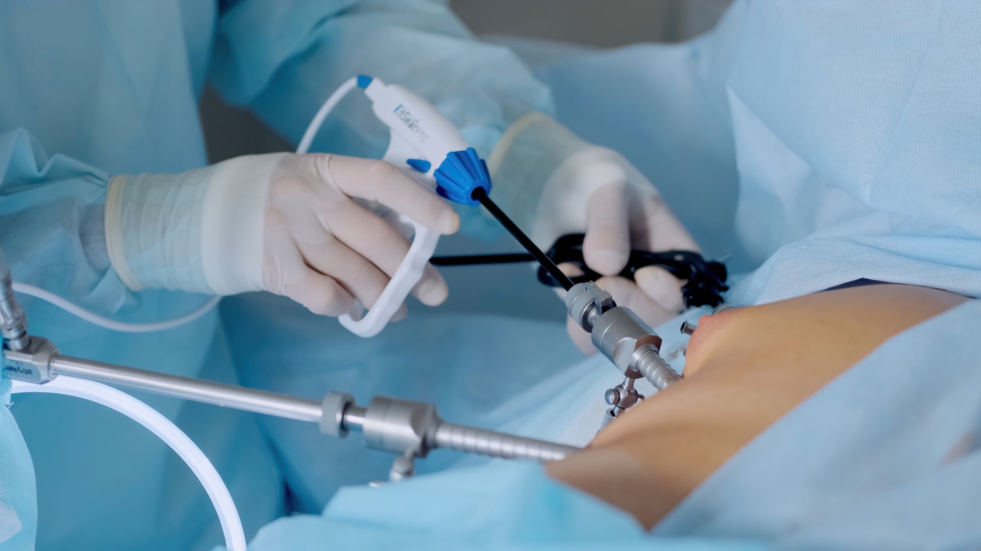 Hands of surgeons with the help of endoscopic equipment and instruments operate. performing laparoscopic surgery using endoscopic and laparoscopic instruments. laparoscopic instrument.