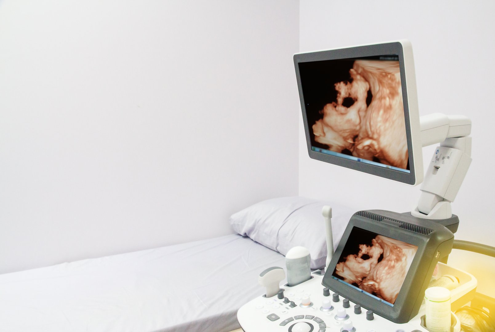 Ultrasound 3D/4D of baby in mother's womb Show on moniter LCD in the room hospital.too soft or out of focus when viewed at full resolution.