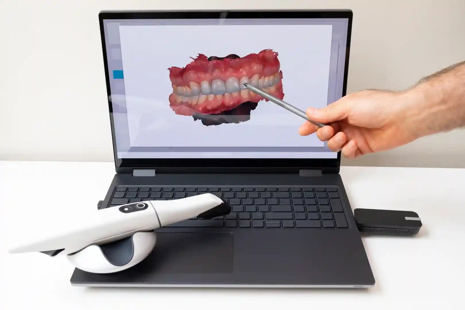 Dentist using CAD/CAM CEREC technology showing 3D scanned digital impressions on computer monitor - advanced dental equipment for same-day crowns, ceramic restorations, and precision dental technology at modern dental practice in Murwillumbah
