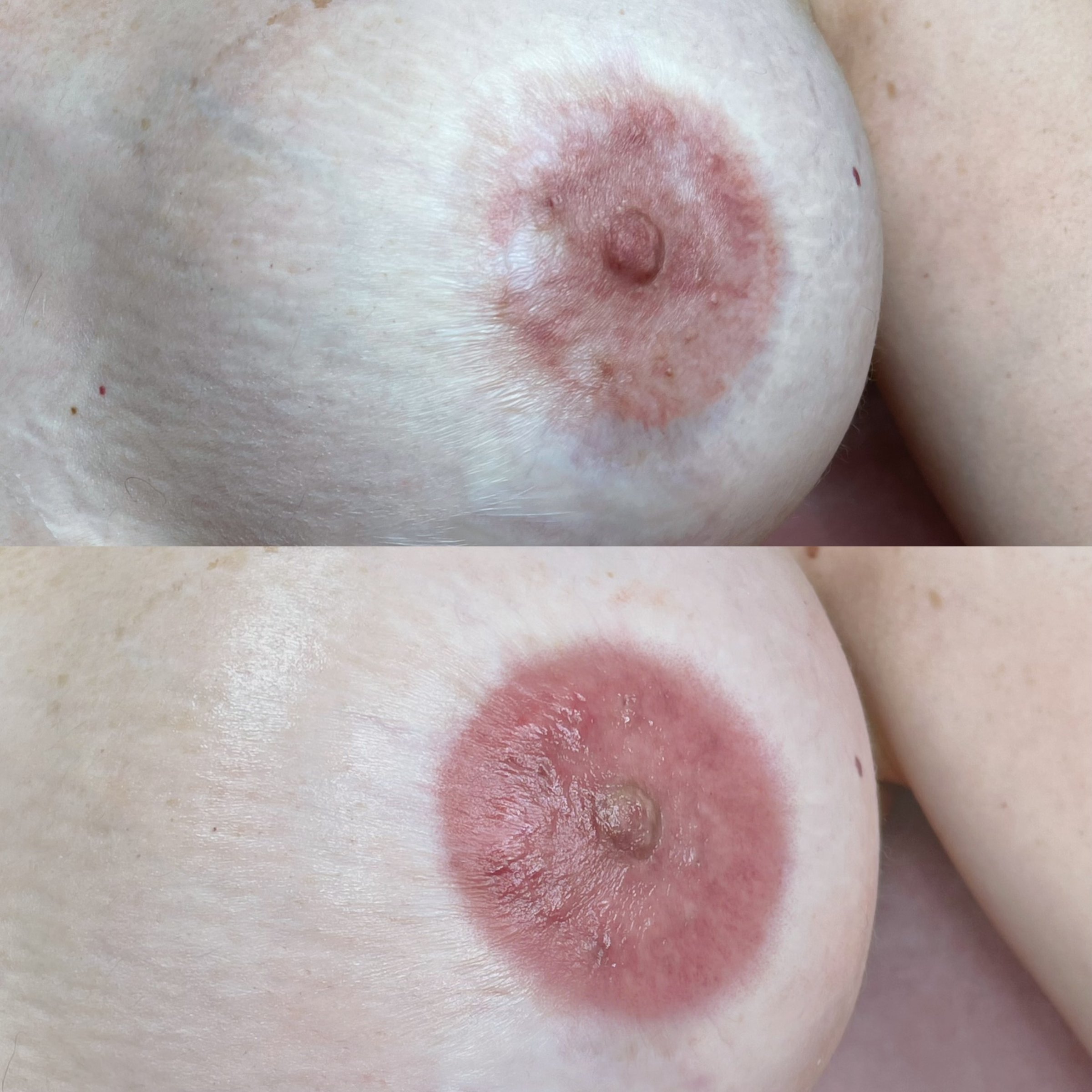 Proceso de Micropigmentación