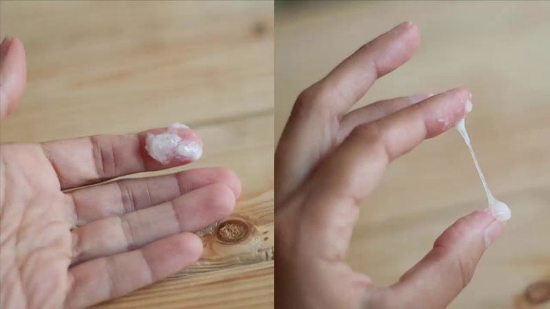 Hình ảnh minh họa dấu hiệu bệnh lậu