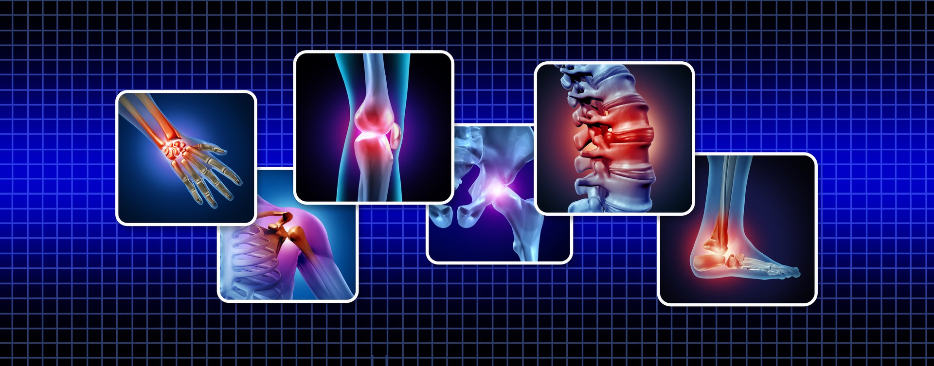 Human Joints Pain concept as skeleton and muscle anatomy of the body with a group of sore joints as a painful injury or arthritis illness symbol for health care and medical symptoms as a symbol of Rheumatology and orthopedics and physical rehabilitation.