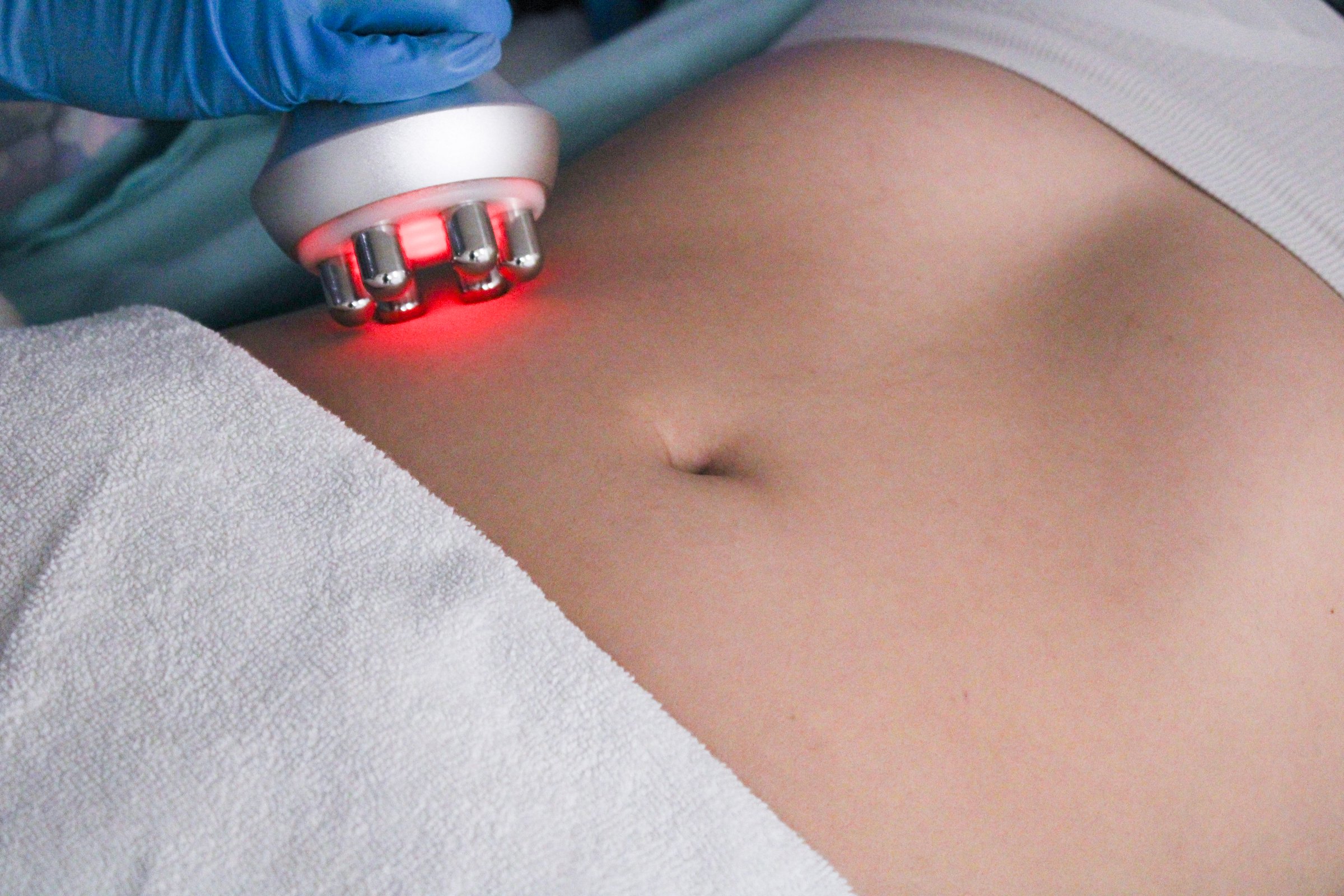 Professional RF body contouring treatment being performed on female abdomen. Non-invasive radiofrequency therapy for skin tightening and cellulite reduction on stomach area. Medical aesthetic procedure using RF technology for body sculpting and fat melting. Beauty spa treatment showing modern body shaping technology application.