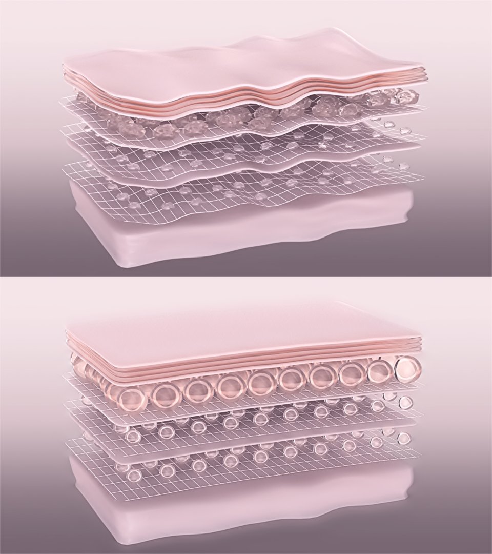 Stylized skin layers before and after wrinkle-removing treatment action of anti-aging collagen-boosting cosmetic products or laser beauty therapy. 3D render
