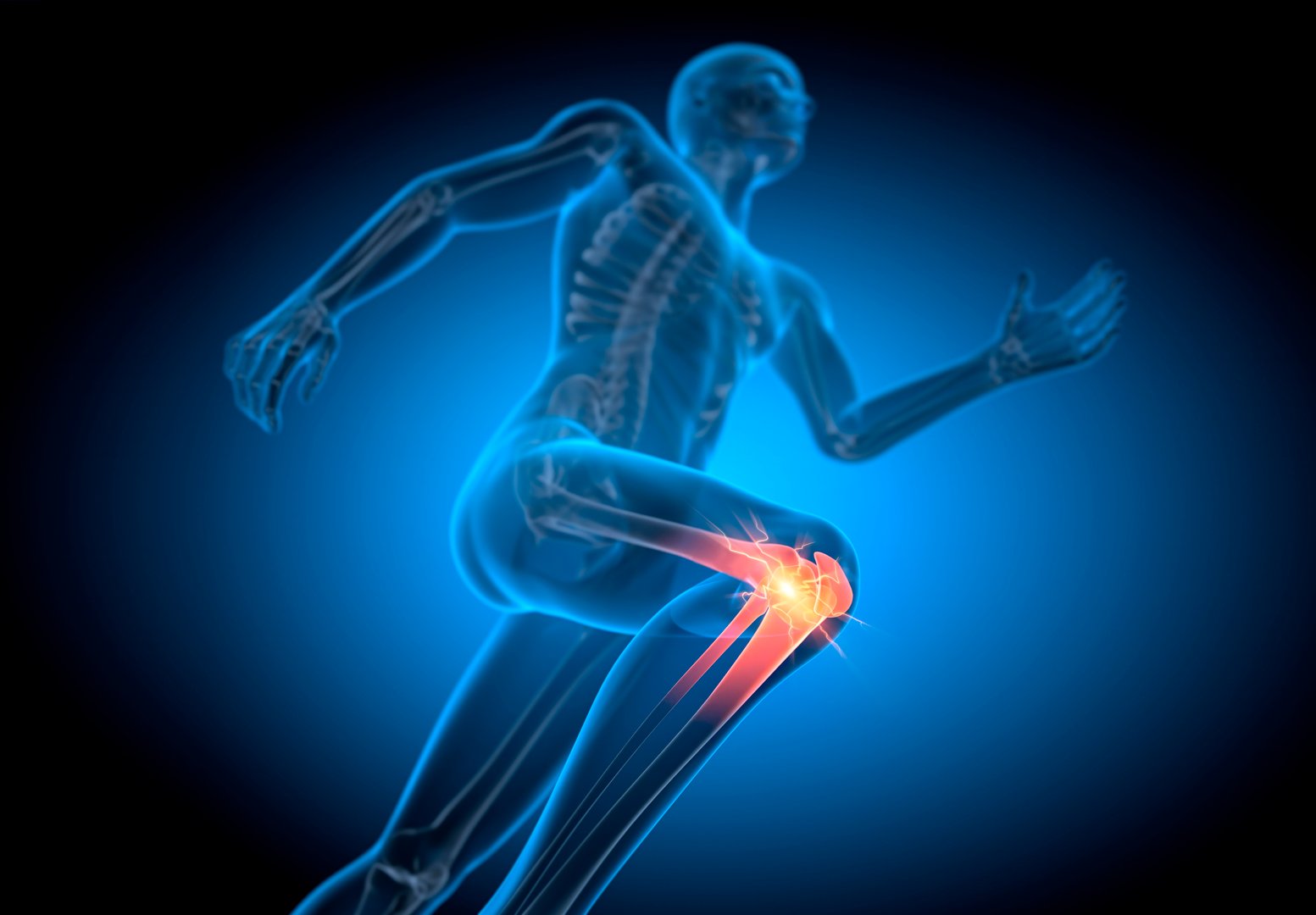 X ray illustration of a running man with knee pain