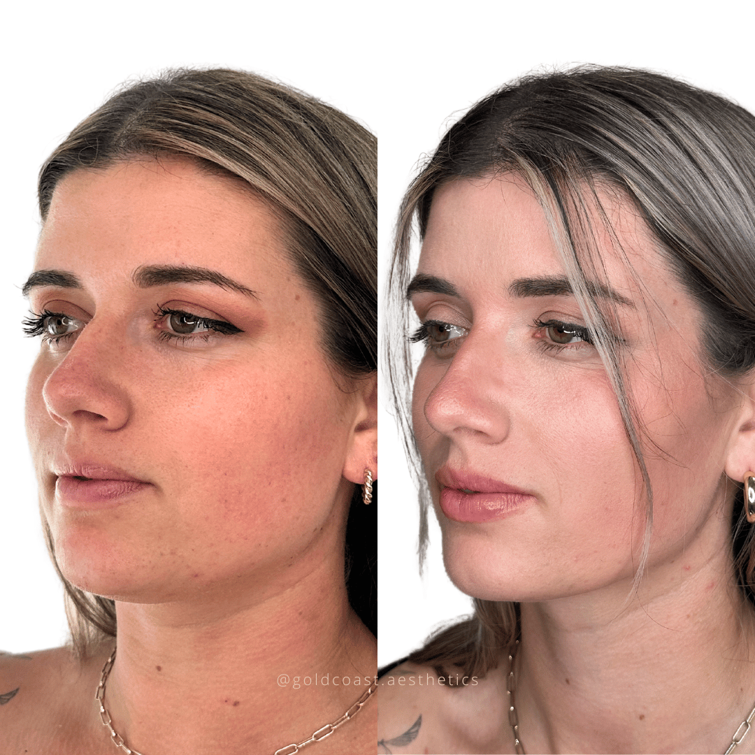 Facial enhancement transformation results