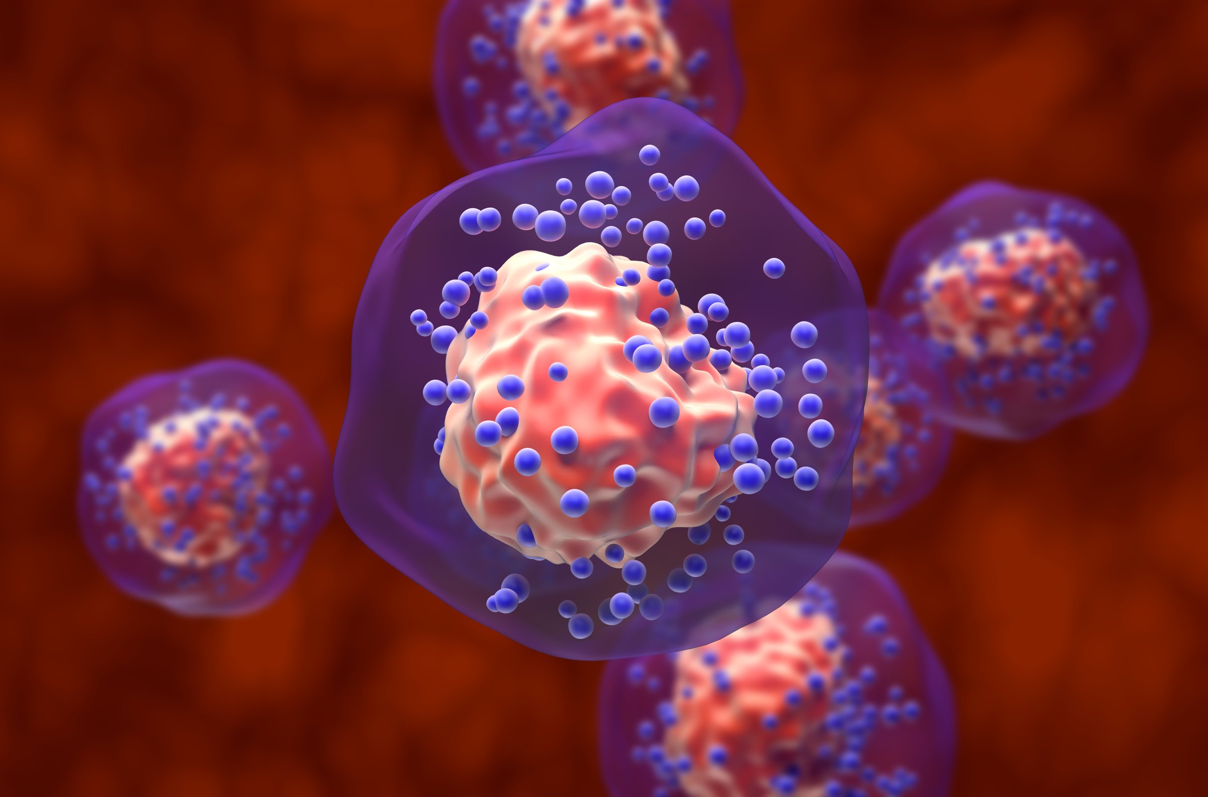 Triple-negative breast cancer (TNBC) is any breast cancer that either lacks or shows low levels of estrogen receptor (ER), progesterone receptor (PR) and human epidermal growth factor receptor 2 (HER2) overexpression and/or gene amplification (i.e. the tumor is negative on all three tests giving the name triple-negative). Triple-negative is sometimes used as a surrogate term for basal-like.