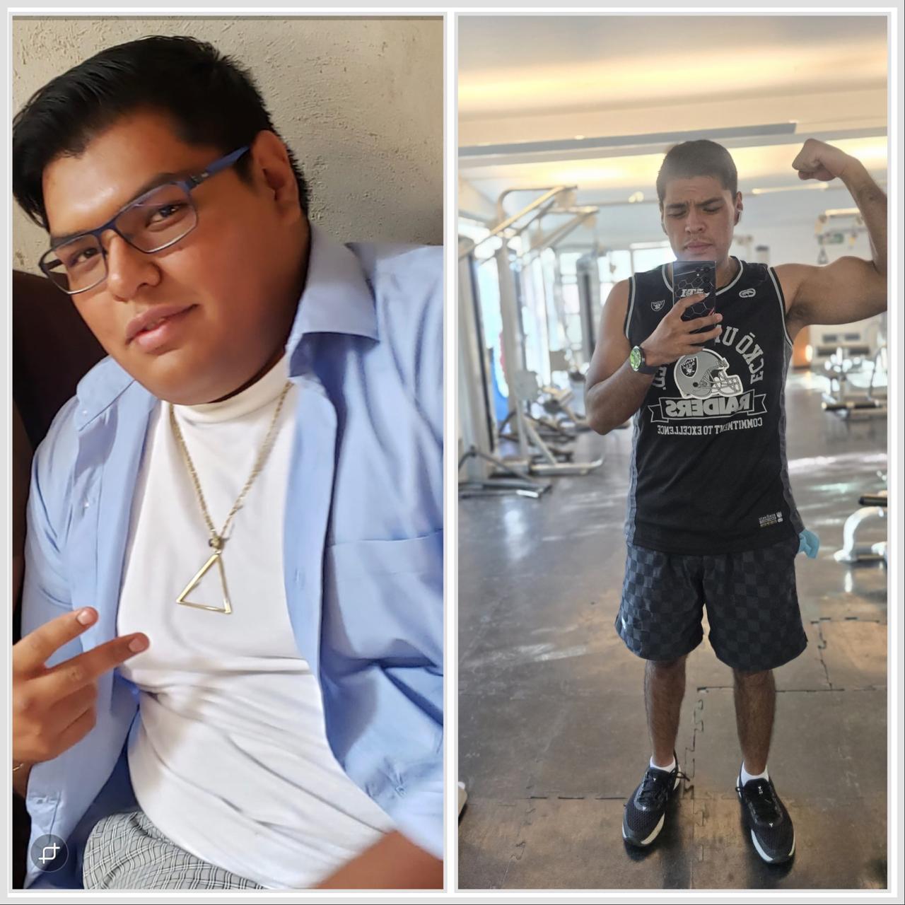 Antes y después del tratamiento nutricional con GLP-1 o GIP