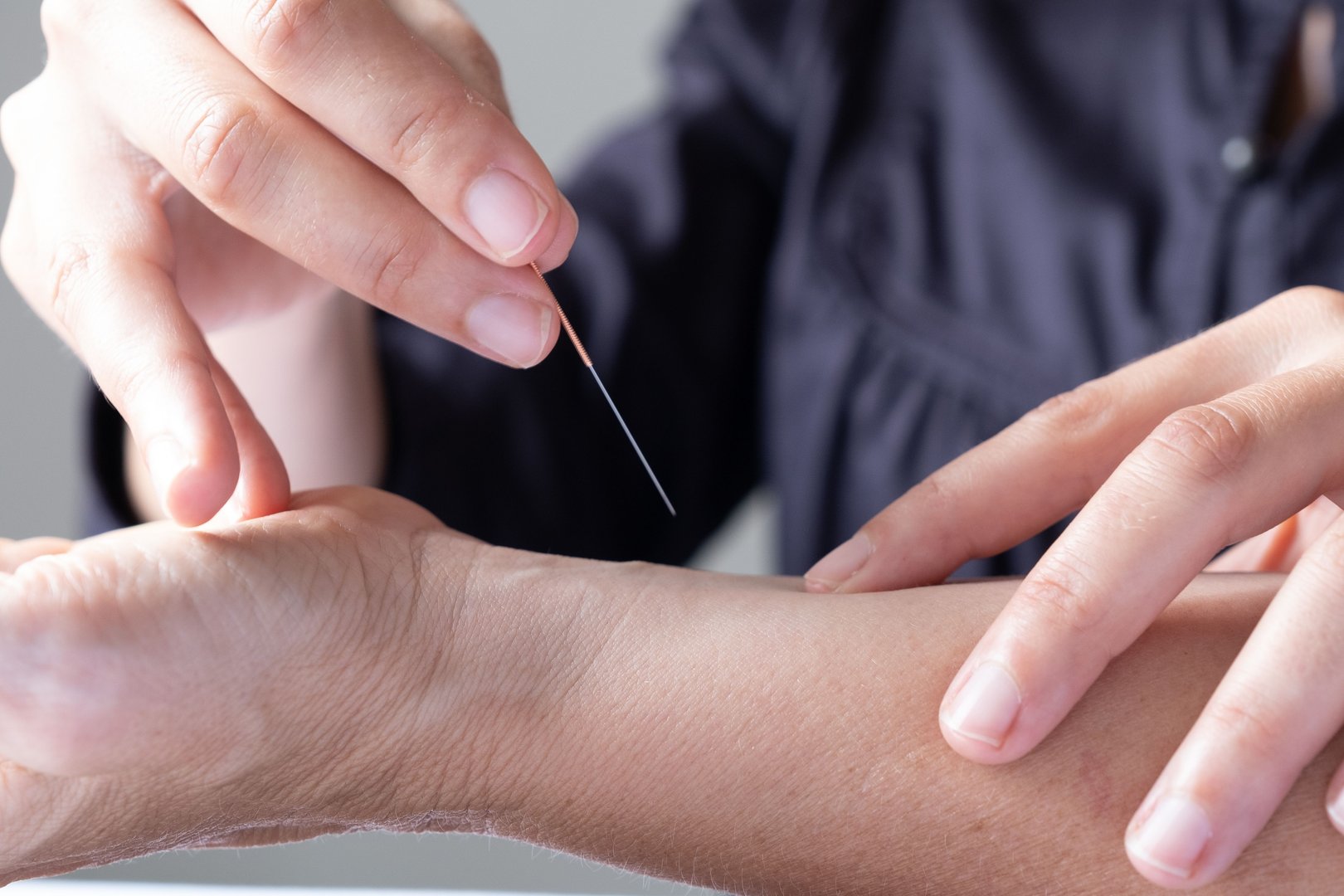 A close-up of acupuncture needle being inserted into a person's wrist during a therapy session in Montreal, Quebec, Canada