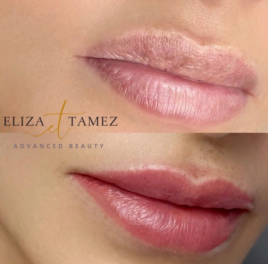 Micropigmentación de labios