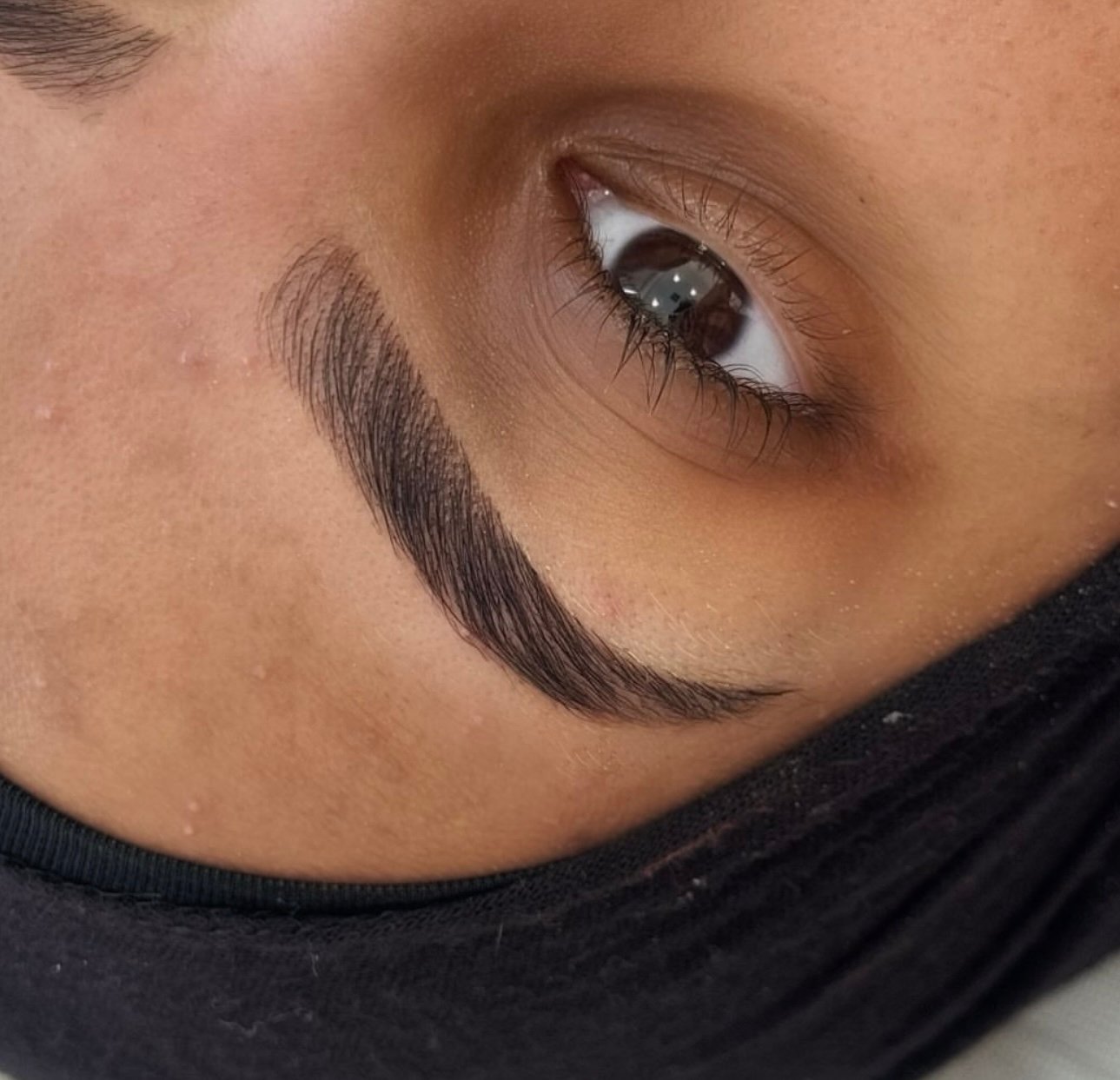 Bonnie Aesthetics client transformation