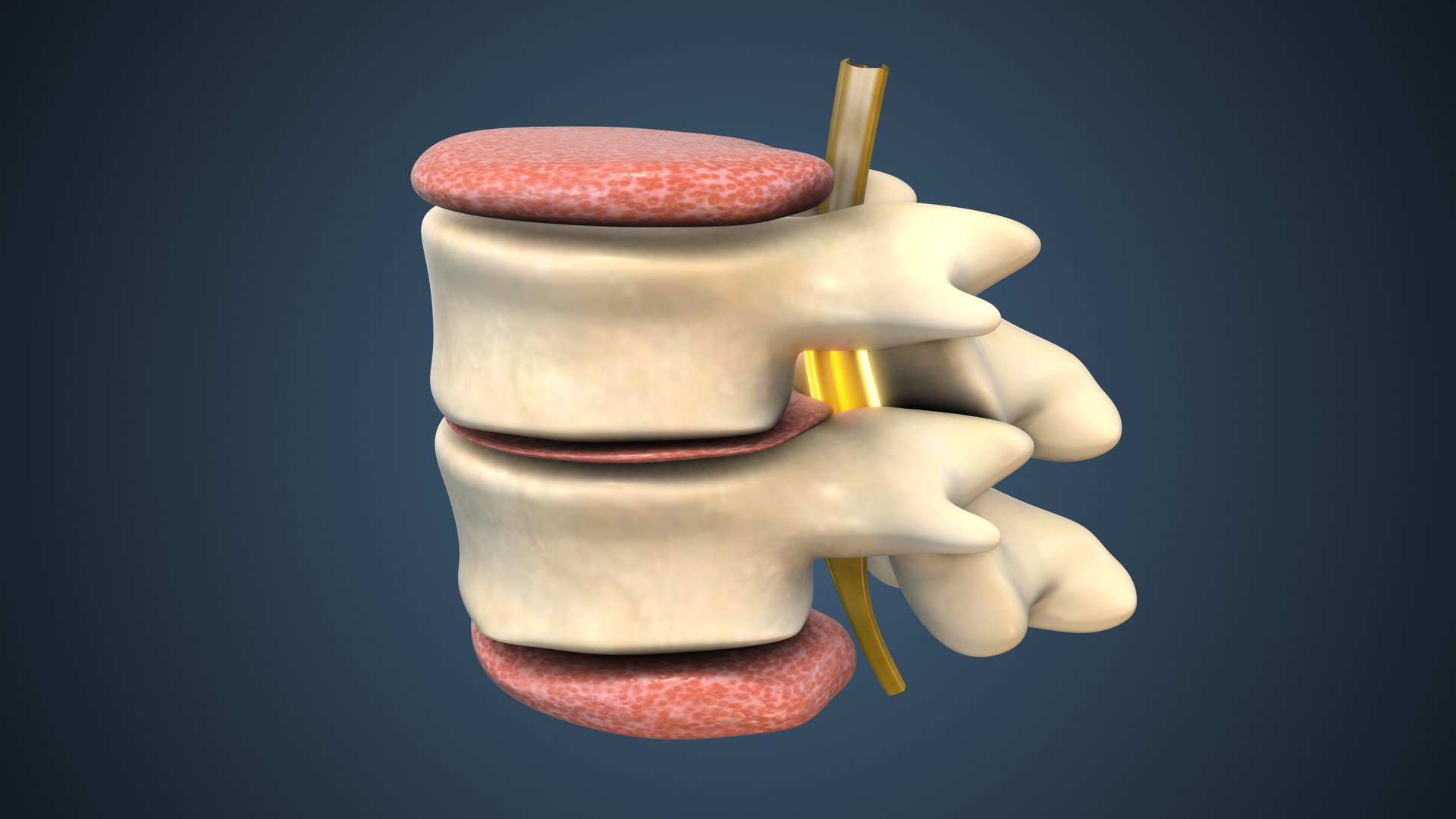 Medical animation video explaining spinal decompression therapy. Visualizes gentle spine stretching to relieve disc and nerve pressure, aiding conditions like herniated discs, sciatica, and spinal stenosis.
