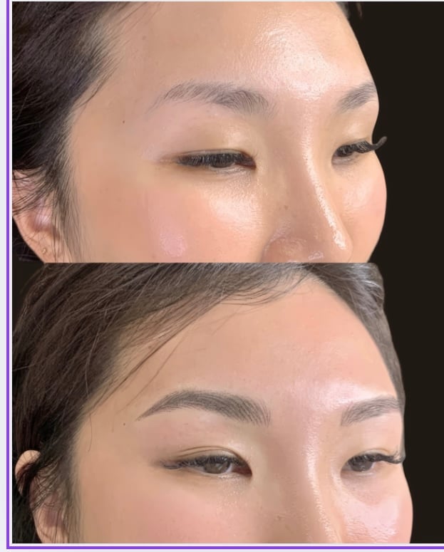 Brow transformation before and after
