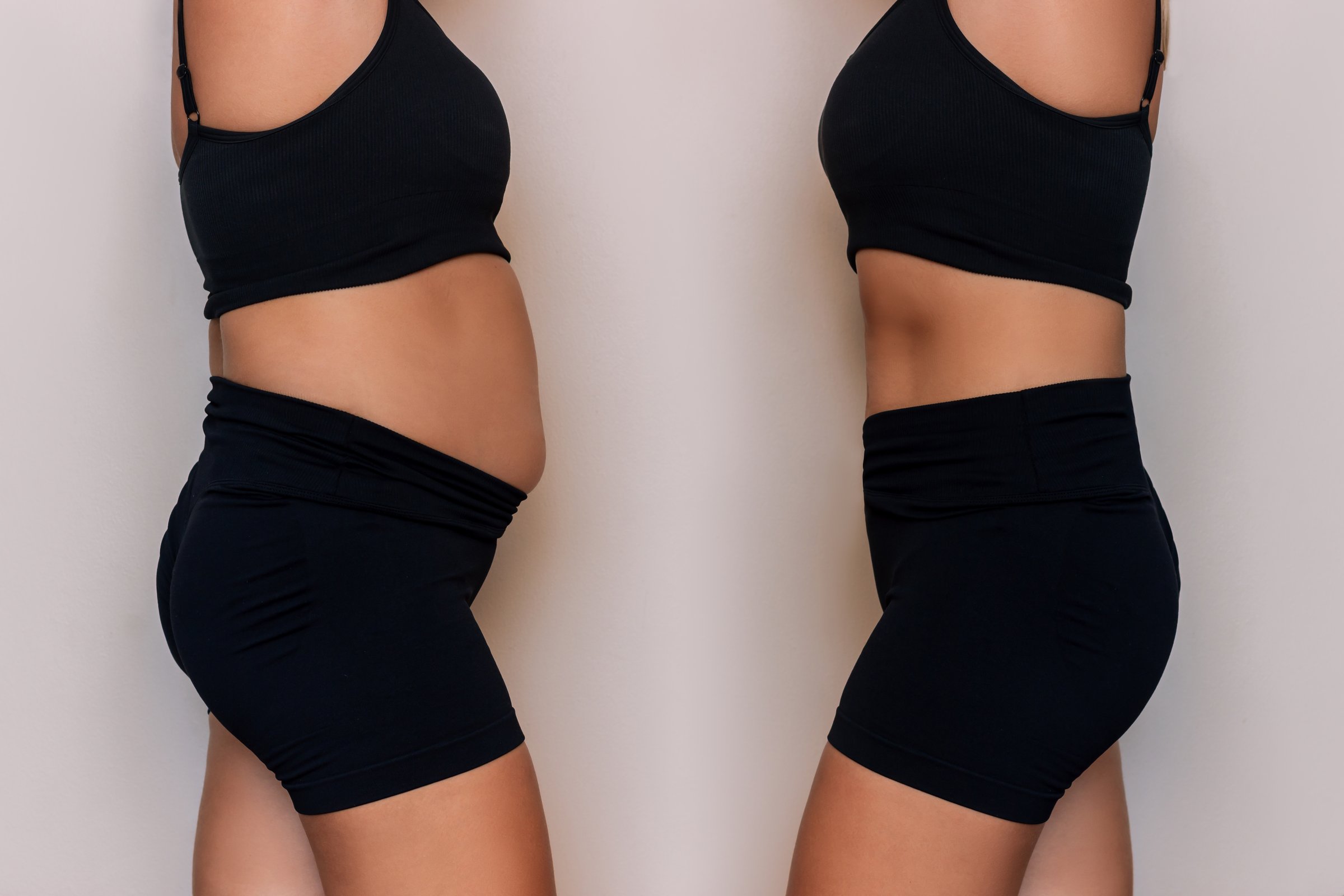 Two shots of a woman in a black sportswear with a fat belly and toned slim abdomen before and after losing weight on gray background. Result of diet, liposuction, training. Getting rid of overweight