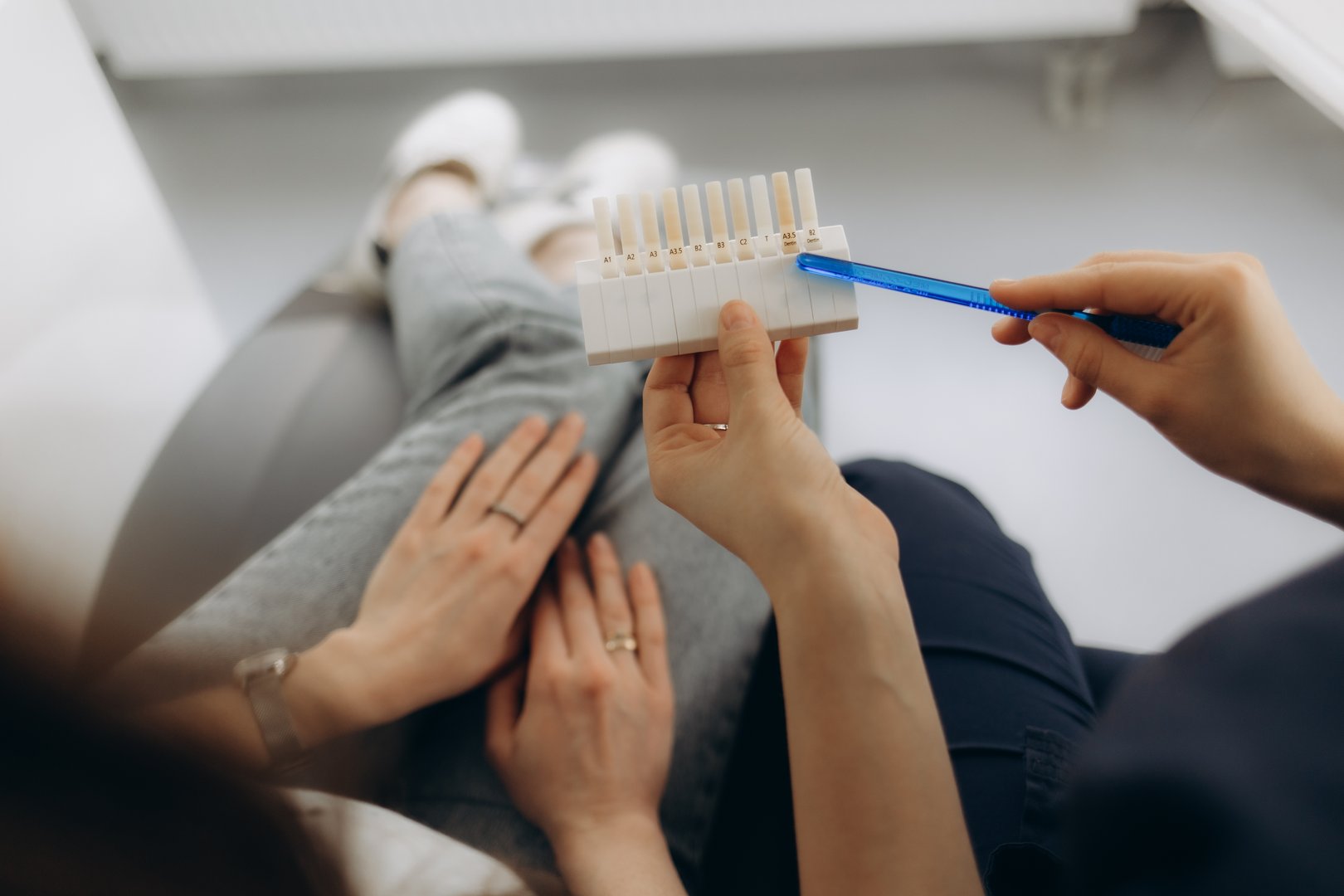 Smile and white teeth of a young woman. Matching the shades of the implants or the process of teeth whitening.