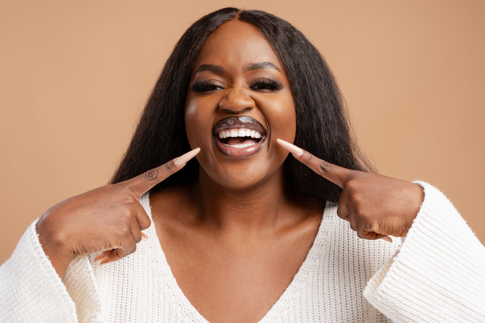 Veneers and whitening transformation - Black African woman