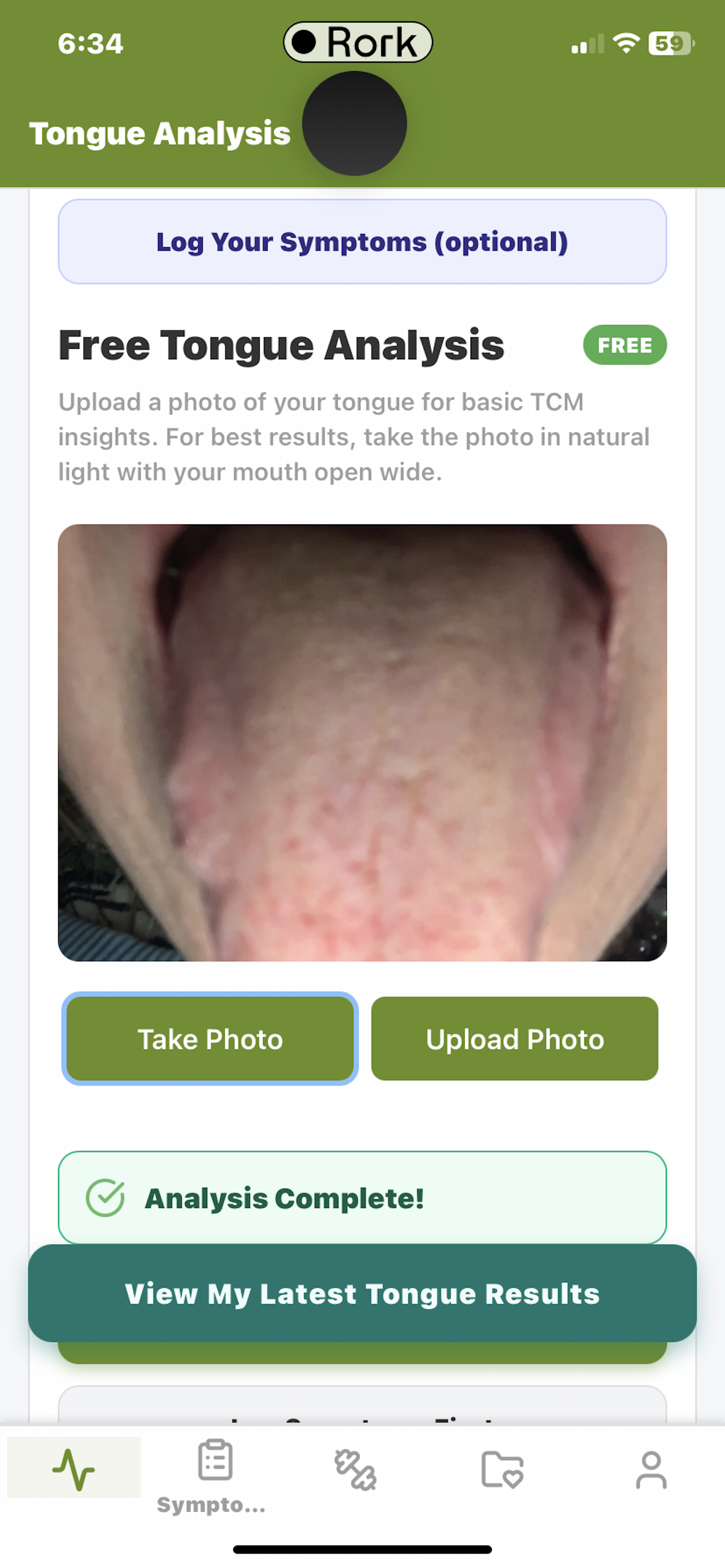 Tongue Analysis and TCM Insights