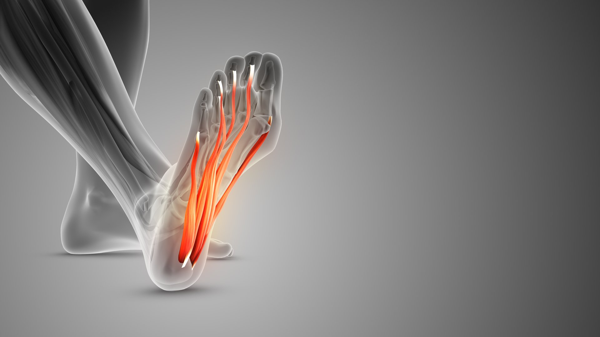 The plantar fascia is a band of tissue, called fascia, that connects your heel bone to the base of your toes. It supports the arch of the foot and absorbs shock when walking. Tension and stress on the fascia can cause small tears.