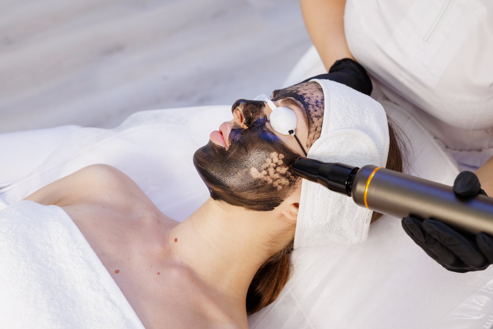 Aesthetician performs carbon laser peel on woman with eye shields and handpiece, a clinical skincare treatment for cleansing acne and rejuvenation.