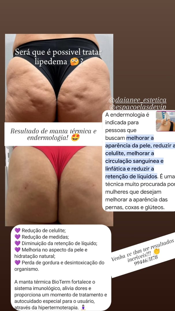 Espaço Elas de Vip - Resultados